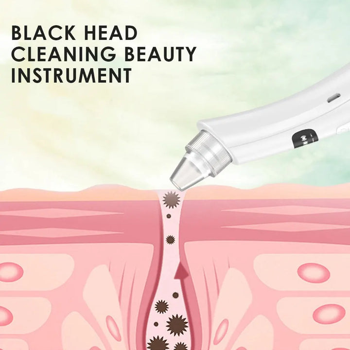 Multifunctional Beauty Pore Vacuum 3 in 1